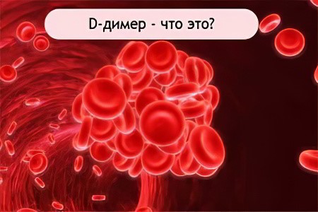 Д-димеры как маркер тромбообразования