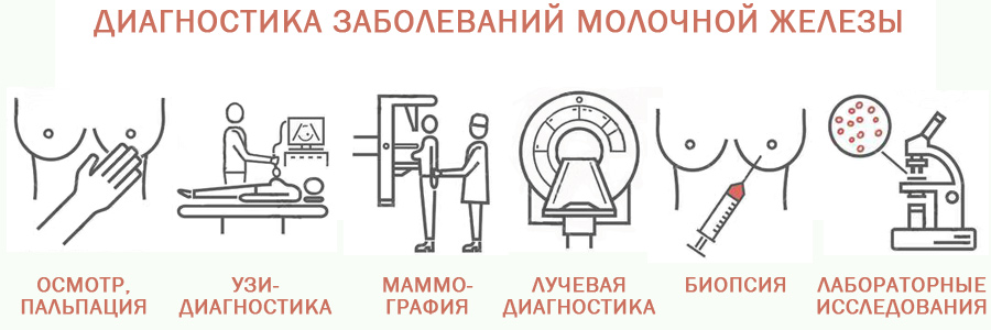 методы диагностики рака молочной железы