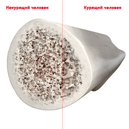 bones.jpg