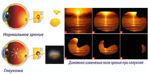 gl1.jpg gl1.jpg