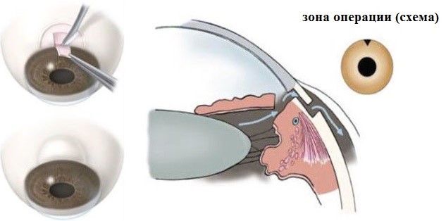 glauk2.jpg glauk2.jpg